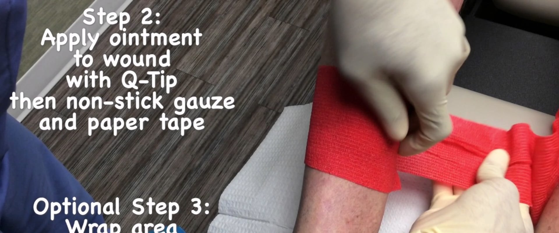 Mupirocin Ointment on Open Wounds: Is It Safe for Use With Wound VAC Therapy?