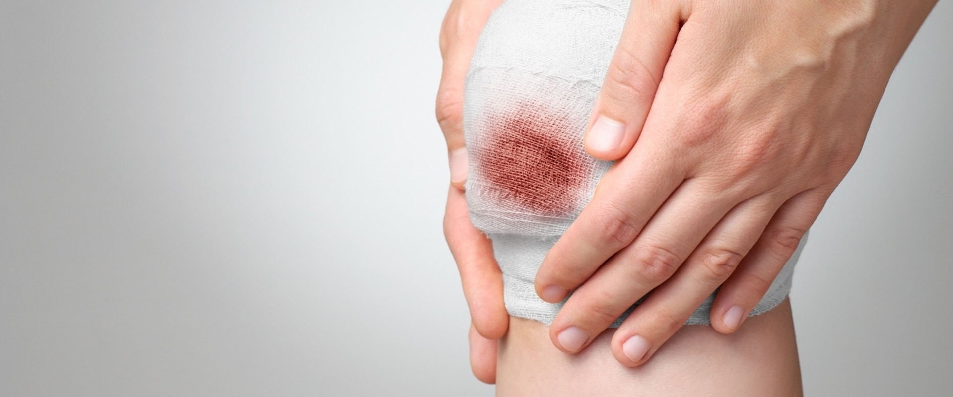 Top Signs of Wound Infection Symptoms to Know for Effective Wound VAC Treatment