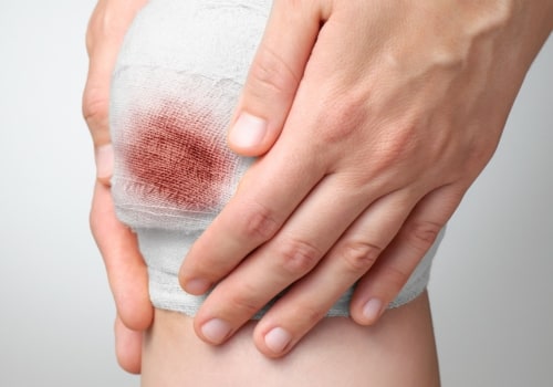 Top Signs of Wound Infection Symptoms to Know for Effective Wound VAC Treatment